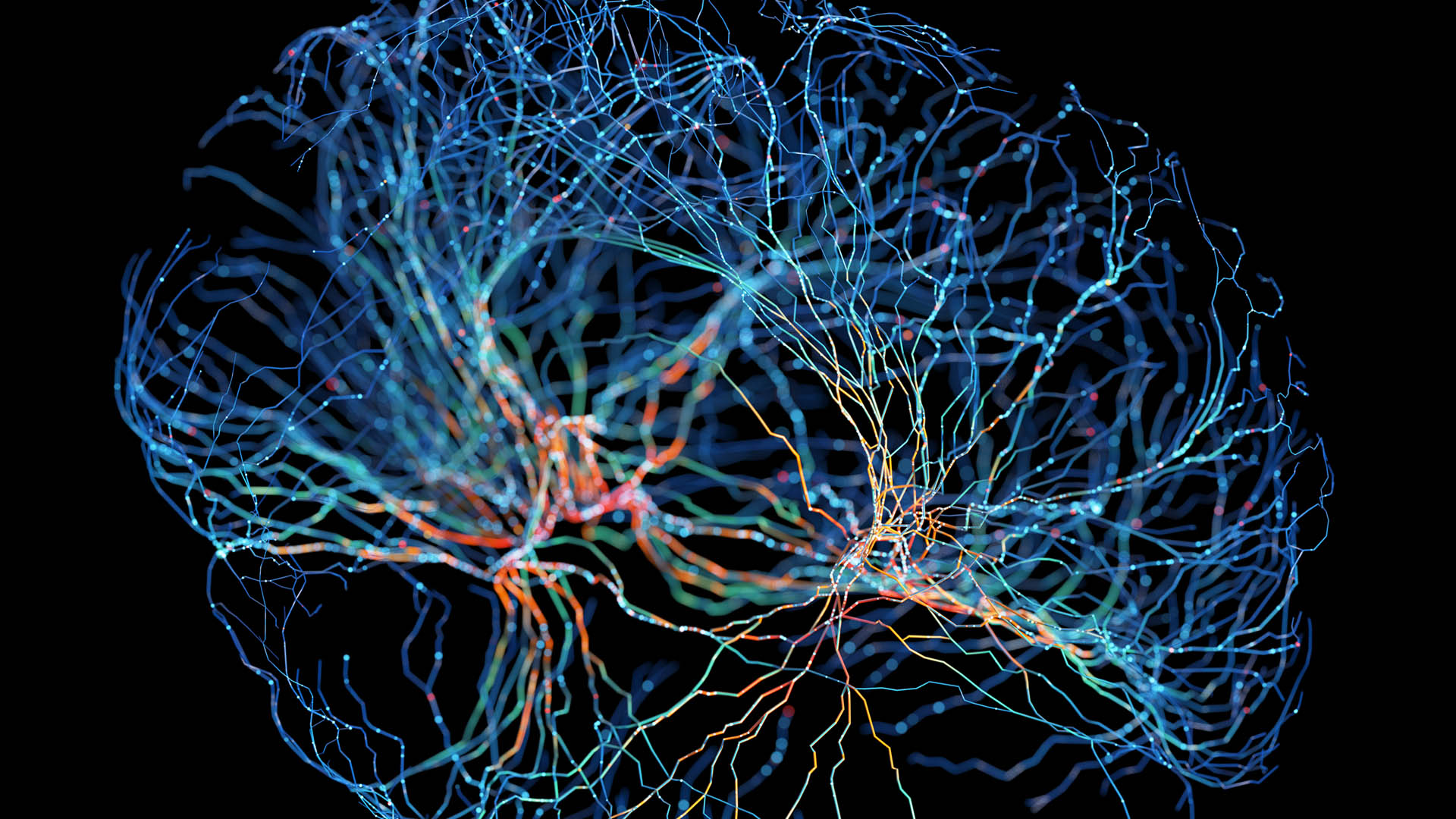 AI brain